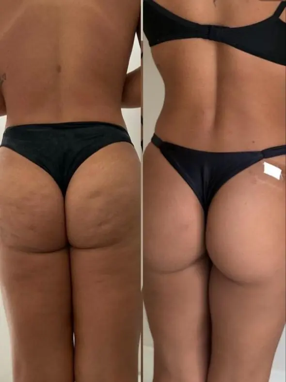 Registro de acompanhamento de paciente, antes e depois