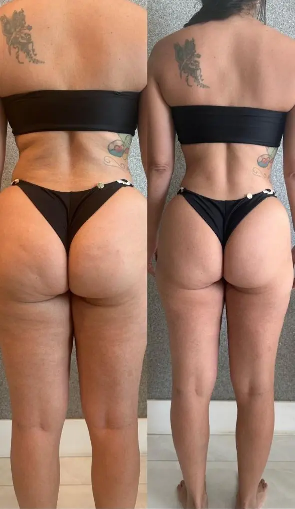 Registro de acompanhamento de paciente, antes e depois