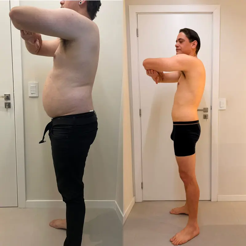 Registro de acompanhamento de paciente, antes e depois