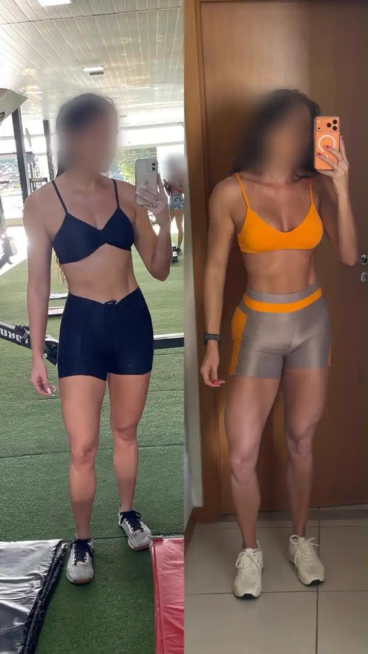 Registro de acompanhamento de paciente, antes e depois