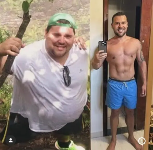 Registro de acompanhamento de paciente, antes e depois