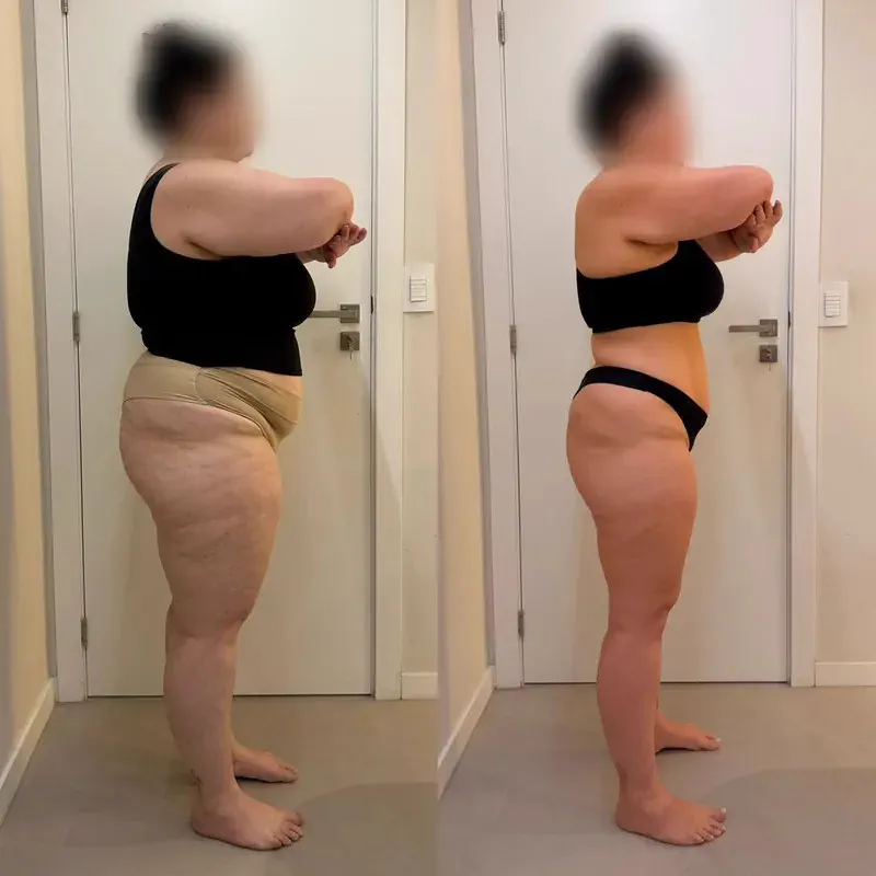 Registro de acompanhamento de paciente, antes e depois