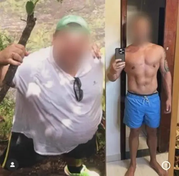 Registro de acompanhamento de paciente, antes e depois