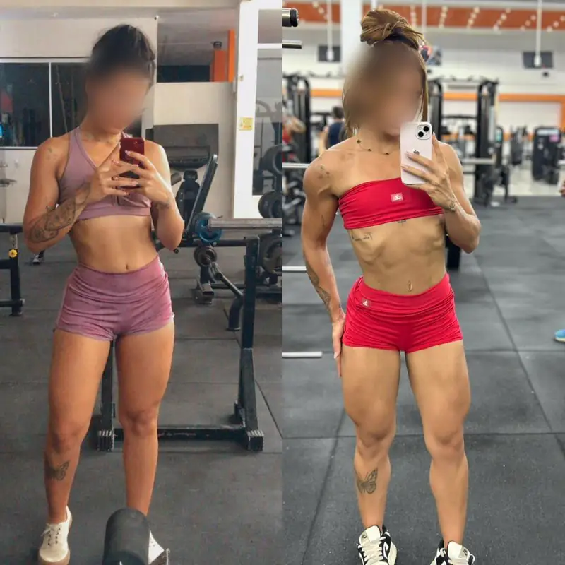 Registro de acompanhamento de paciente, antes e depois