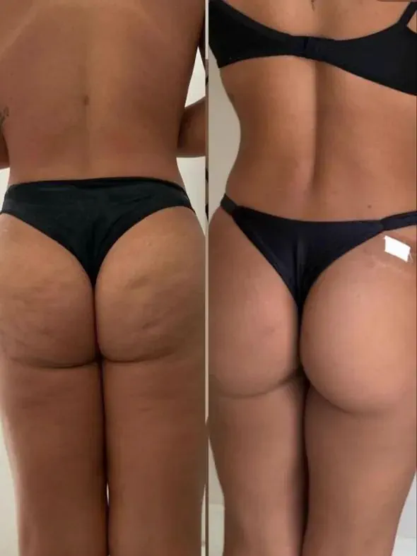 Registro de acompanhamento de paciente, antes e depois